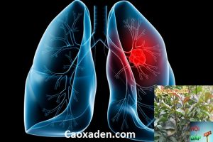 Bố bị ung thư phổi có nên dùng  cây xạ đen không ?