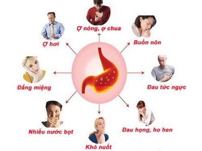 Những nguyên nhân chính gây ra bệnh đau dạ dày